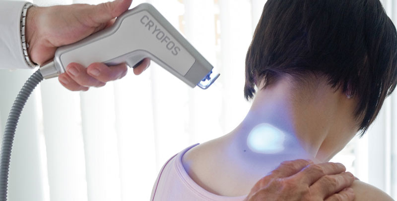 CRYOFOS – Kältereiztherapie CRYOFOS – Kältereiztherapie