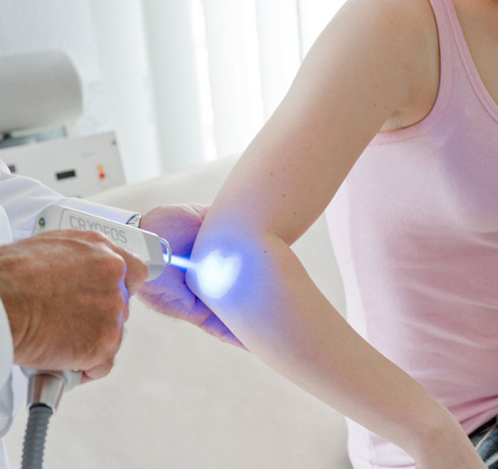 CRYOFOS – Kältereiztherapie im medsyn CRYOFOS – Kältereiztherapie im medsyn