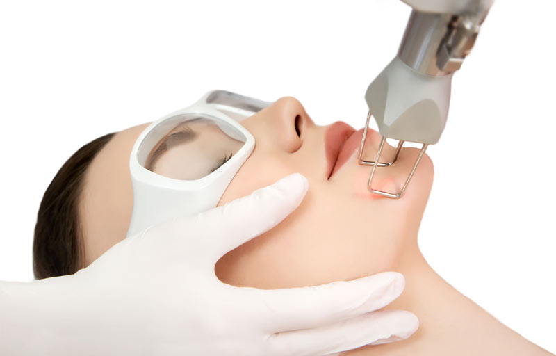 Hochmoderne Laserbehandlung im medsyn Gesichtsbehandlung durch einen Laser. Patientin trägt Schutzbrille und der Arzt macht eine Gesichtsbehandlung