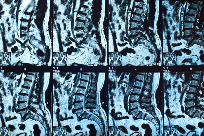 Analyse und Diagnose im medsyn