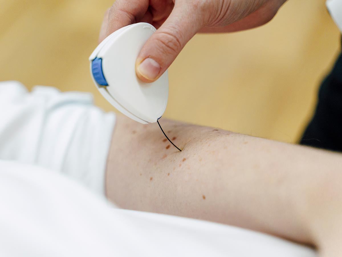 Claudia Carta BSc MA, Quantitative sensory testing