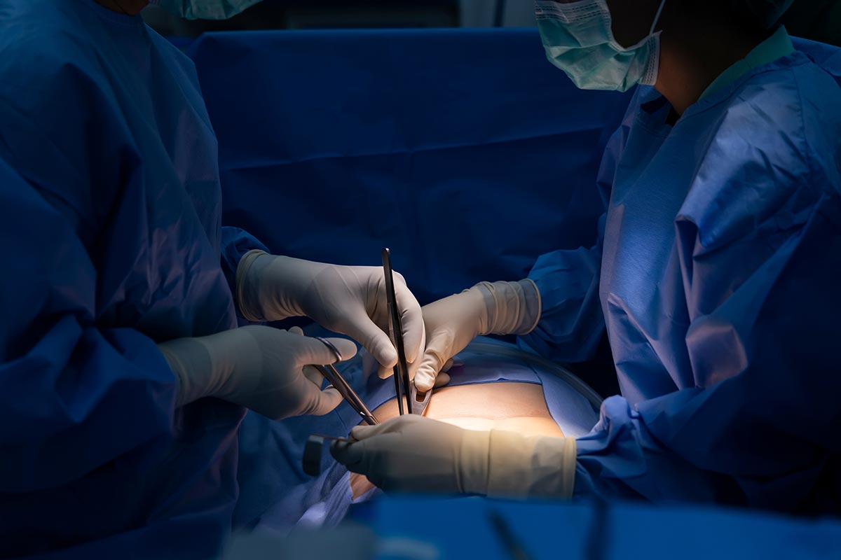 spinalkanalstenose_medsyn