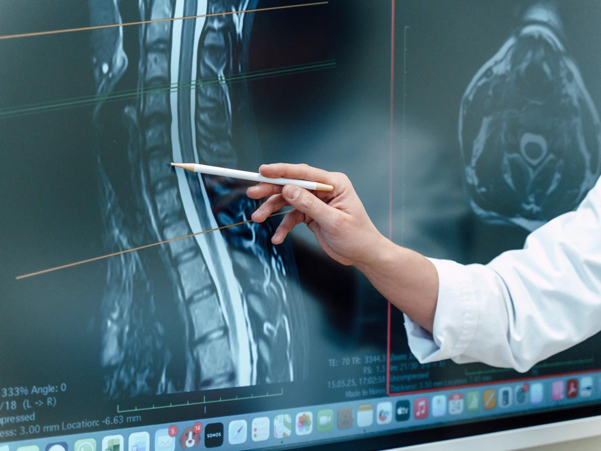 jakob-jan-zagata-osteoporotische-frakturen-dsc08597